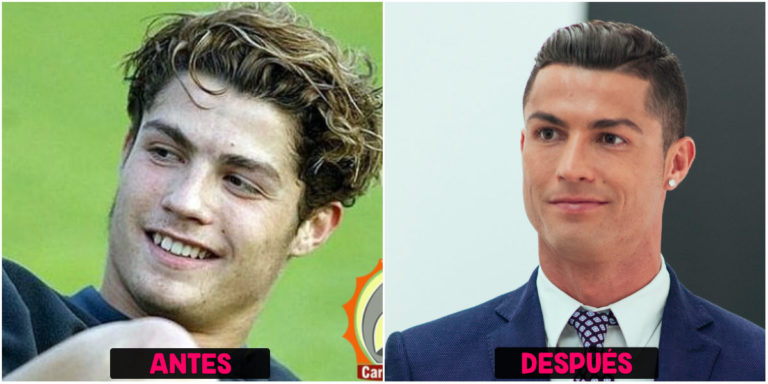 Cirugías De Cristiano Ronaldo Antes Y Después Cirugias De