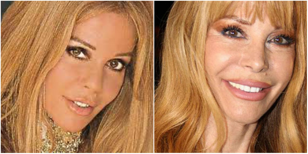 Cambios de Graciela Alfano antes y después