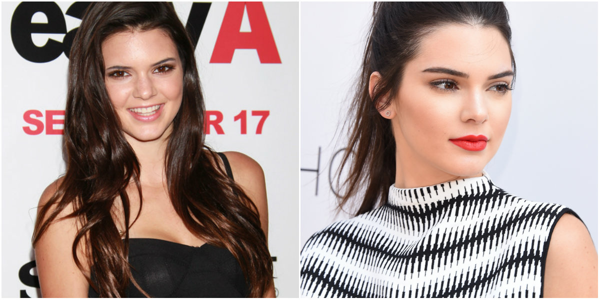 Cambios de Kendall Jenner