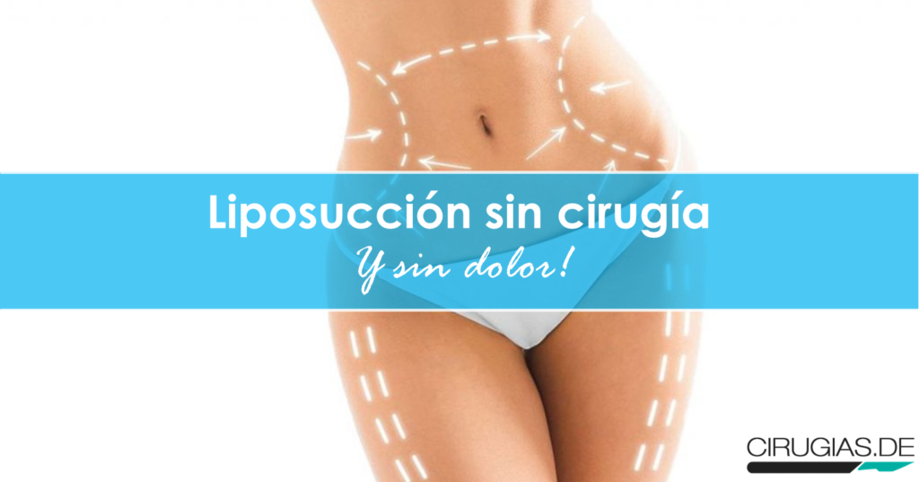 Liposucción sin cirugía