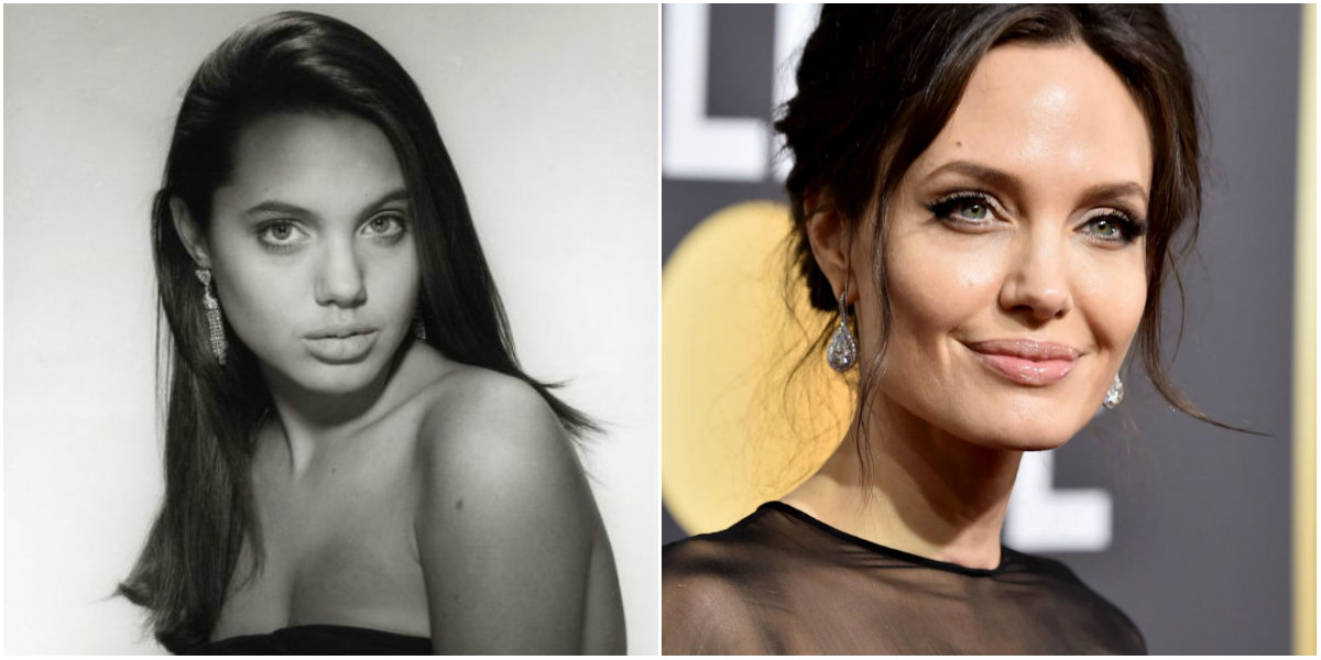 Rinoplastia de Angelina Jolie