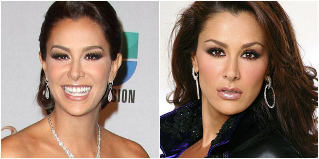 Cirugías de Ninel Conde (+Antes y Después) Cirugias.de