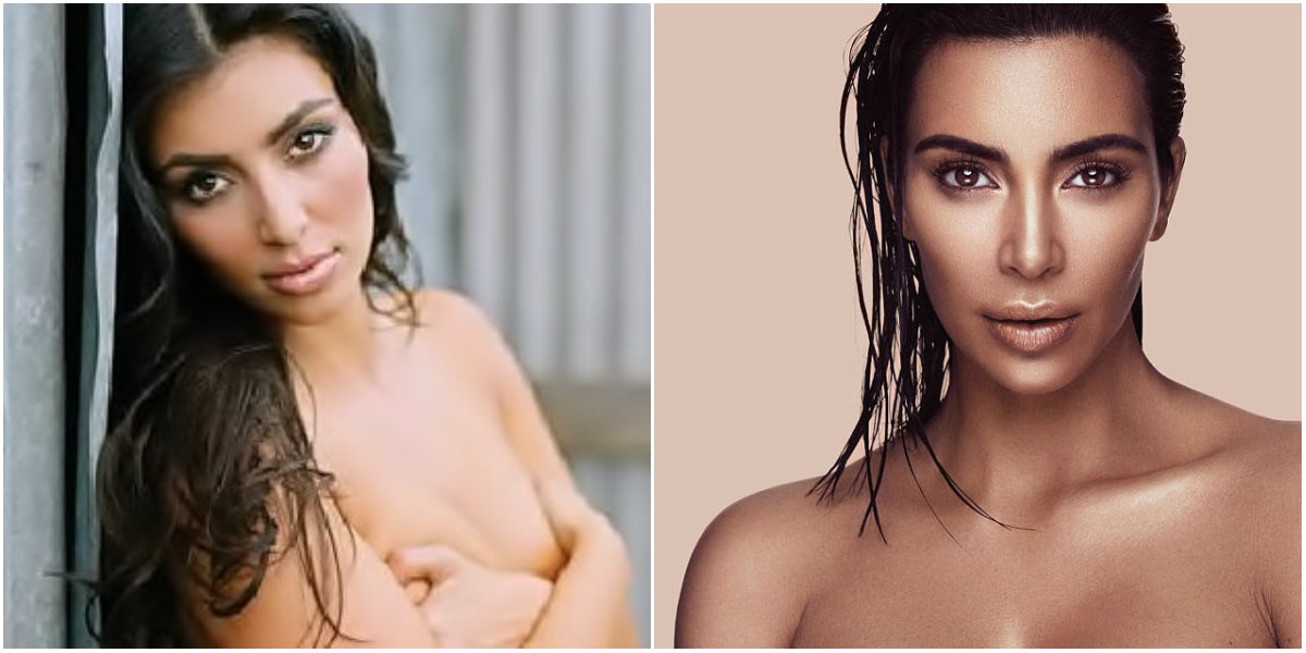 Kim Kardashian West y sus cirugías