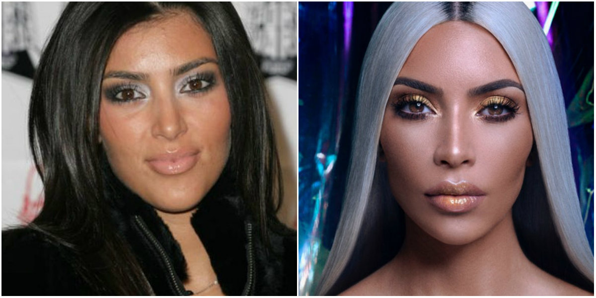 Kim Kardashian cirugías
