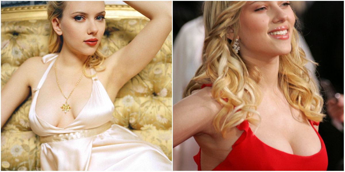 Cirugías de Scarlett Johansson