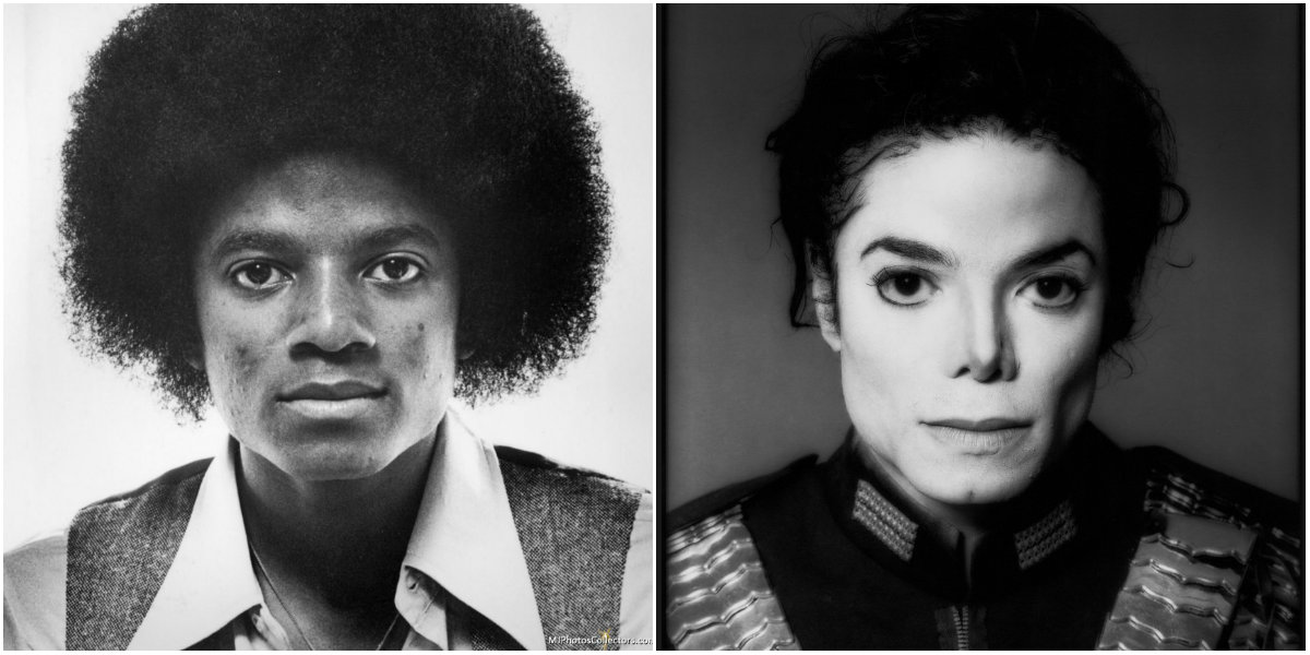 Michael Jackson cirugia