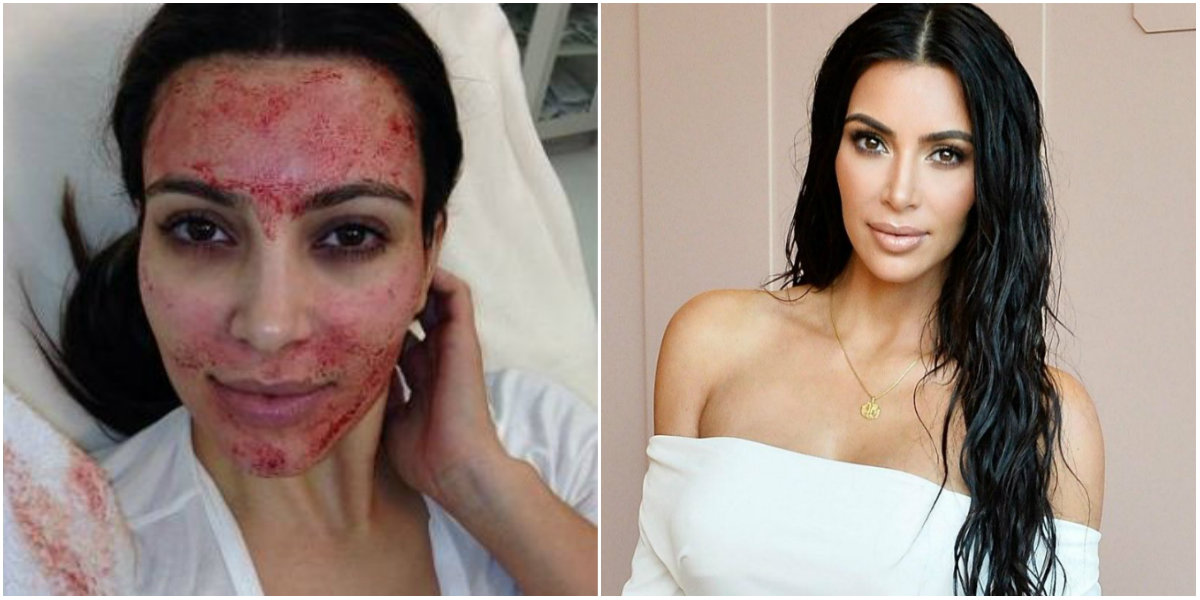 Tratamientos de belleza de Kim Kardashian