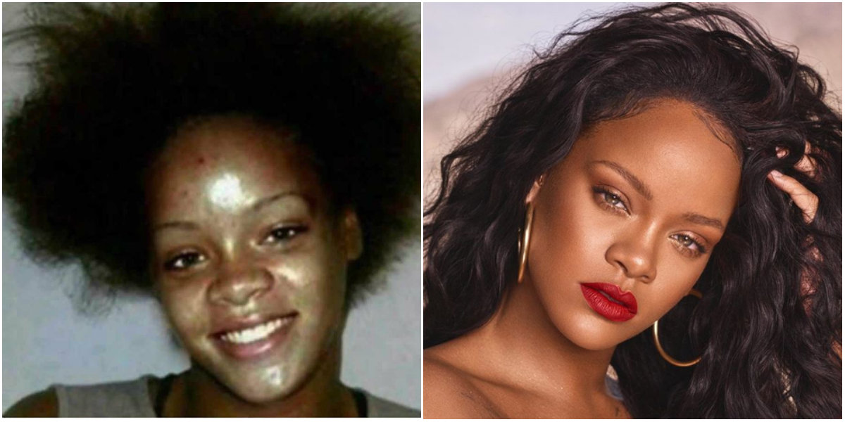 Antes y después de Rihanna