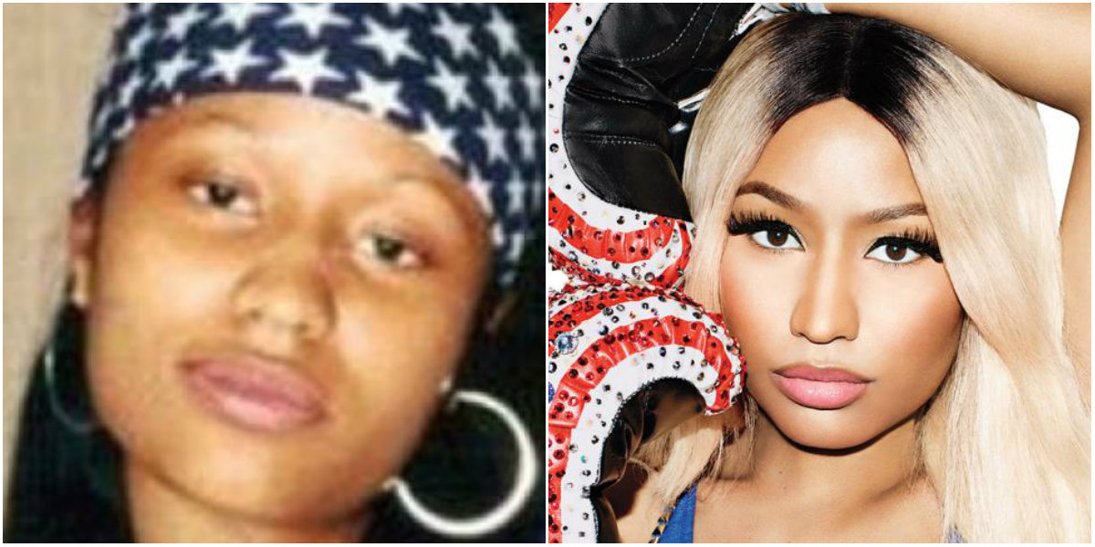Nicki Minaj antes y después de las operaciones